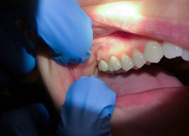 Best Emergency Treatment for Toothache in Atkins, IA