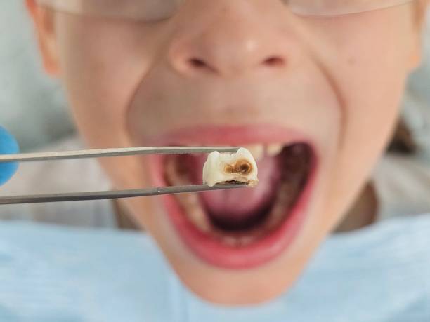 Best Urgent Dental Care in Atkins, IA