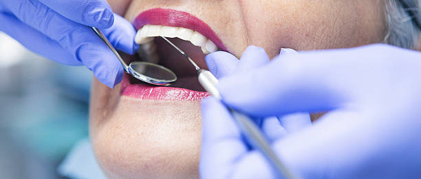 Best Emergency Wisdom Teeth Removal in Atkins, IA